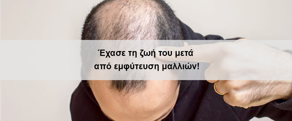 exase-ti-zwi-tou-meta-apo-emfiteusi-malliwn