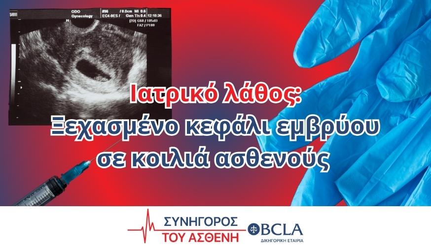 Ιατρικό λάθος: Ξεχασμένο κεφάλι εμβρύου σε κοιλιά ασθενούς - Αποζημίωση 150.000€